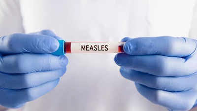  Measles outbreak: Two more states in the US report new cases