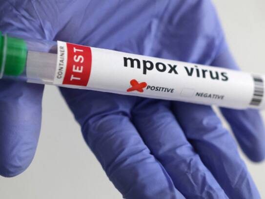 Pak confirms second case of mpox in 2025